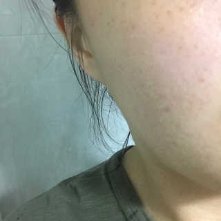 뷰디아니 지친 내 피부를 위한 첫 수분 모이스트 01 토너 — 4점을 준 리뷰어가 2018년 5월 올린 사용 사진