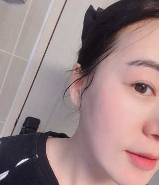 타임인네이처 [더메디닥터] 카렌듈라 엔자임 필링젤 — 5점을 준 리뷰어가 2019년 3월 올린 사용 사진