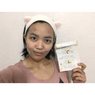 thedeilyskin님이 올린 리뷰 사진 2