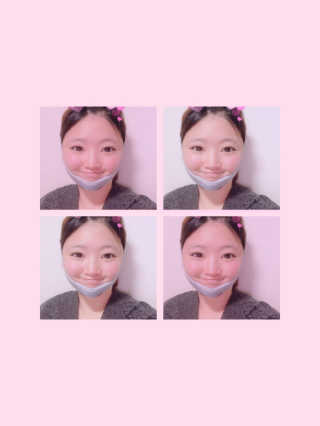 메디미 브이미 업 2스텝 브이라인벨트 — 4점을 준 리뷰어가 2017년 10월 올린 사용 사진