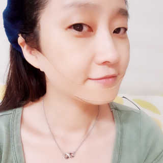 아이디플라코스메틱 아이디 페이스핏 마이너스 밴드 — 5점을 준 리뷰어가 2019년 9월 올린 사용 사진