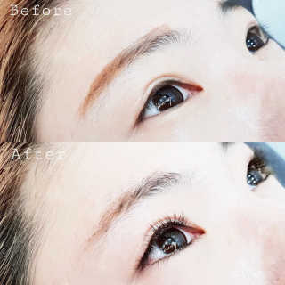 Viewty Skin and Lash [ViewtySkin＆Lash] 종아리 림프순환 부종관리 — 5점을 준 리뷰어가 2019년 3월 올린 사용 사진