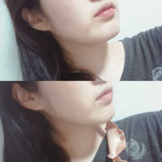 아이디플라코스메틱 아이디 페이스핏 마이너스 밴드 — 4점을 준 리뷰어가 2020년 3월 올린 사용 사진