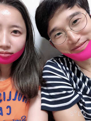 스케덤 펩타이드 리프팅밴드 — 3.5점을 준 리뷰어가 2019년 2월 올린 사용 사진
