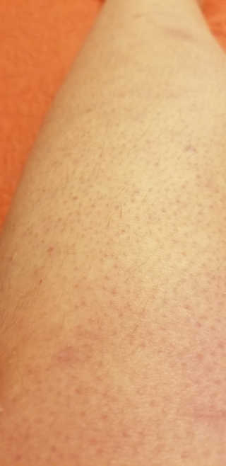 Nyoung1990님이 올린 리뷰 사진 3
