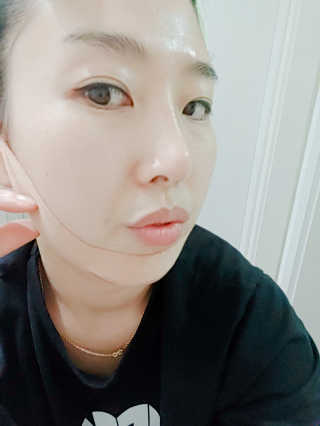아이디플라코스메틱 아이디 페이스핏 마이너스 밴드 — 4점을 준 리뷰어가 2020년 1월 올린 사용 사진