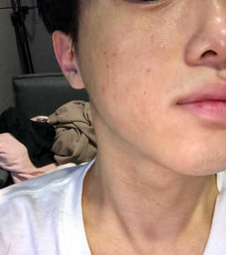 오가나셀 펩타이드 리얼 앰플 — 5점을 준 리뷰어가 2019년 10월 올린 사용 사진