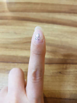 필린 릿티커 — 4점을 준 리뷰어가 2018년 10월 올린 사용 사진