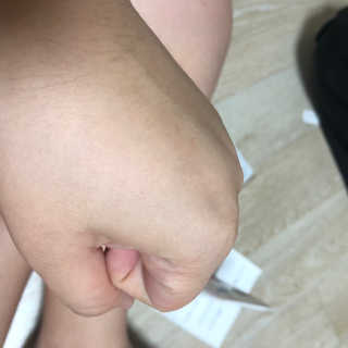 키덤스 베이비 인텐스 크림 — 5점을 준 리뷰어가 2018년 11월 올린 사용 사진