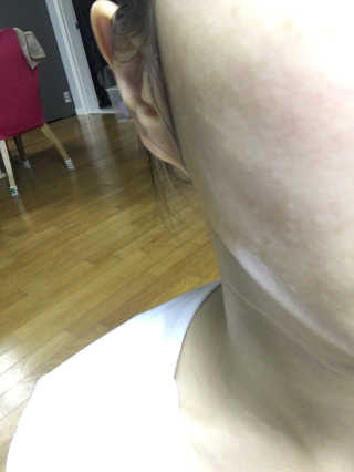 나이팅게일 데일리 더마 클렌징패드 마일드 — 5점을 준 리뷰어가 2018년 8월 올린 사용 사진