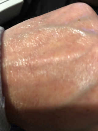 [마녀 공장] 발가락 토미 니아신 에센스 50ml — 5점을 준 리뷰어가 2018년 11월 올린 사용 사진