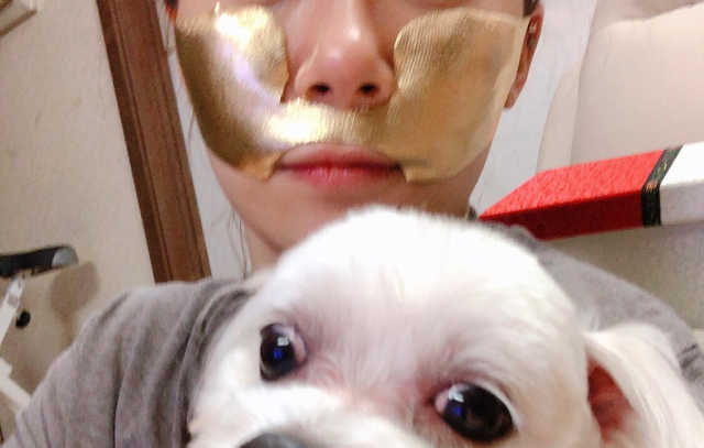 [스케덤] 상악밴드 리뷰 사진