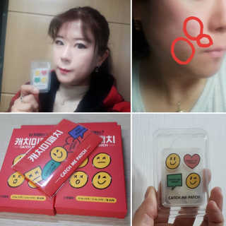 캐치미패치 트러블 스팟패치 — 5점을 준 리뷰어가 2019년 12월 올린 사용 사진