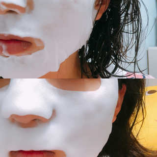 오오티유 비포 앤 애프터 산소 버블 마스크 시트 — 5점을 준 리뷰어가 2018년 7월 올린 사용 사진