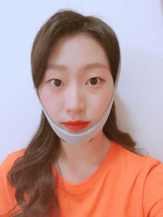 메디미 브이미 업 2스텝 브이라인벨트 — 3.5점을 준 리뷰어가 2017년 9월 올린 사용 사진