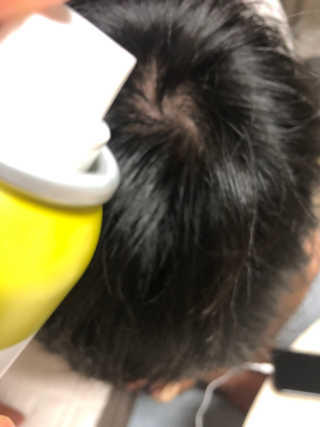 달리프 클로렐라 베러 루트 쿨링 스프레이 100ml — 4.5점을 준 리뷰어가 2019년 7월 올린 사용 사진