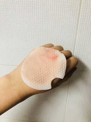 나이팅게일 데일리 더마 클렌징패드 마일드 — 5점을 준 리뷰어가 2018년 3월 올린 사용 사진