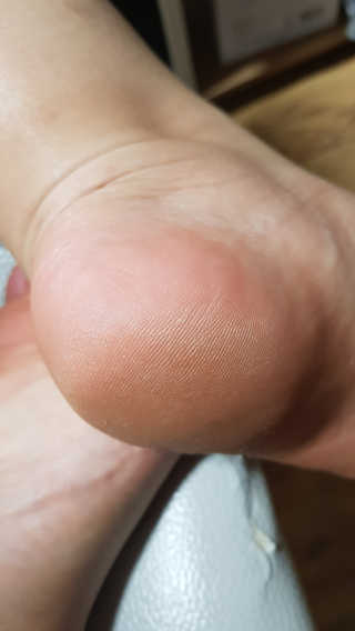 케라셀 풋크림 케라셀 인텐시브 풋 리페어 — 5점을 준 리뷰어가 2019년 11월 올린 사용 사진