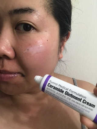 Emogurloveskincare님이 올린 리뷰 사진 2