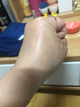 나이팅게일 티타민 크림 리뉴얼 — 5점을 준 리뷰어가 2018년 4월 올린 사용 사진