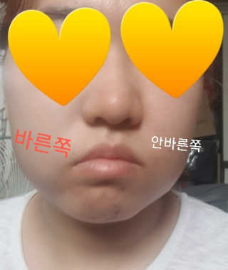 에끌라두 화이트닝 인핸서 선 블래미쉬 밤 비비크림 — 4점을 준 리뷰어가 2019년 6월 올린 사용 사진