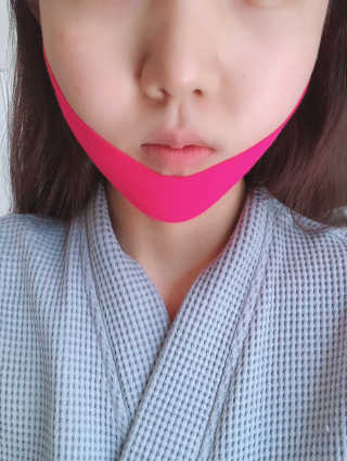 스케덤 펩타이드 리프팅밴드 — 3.5점을 준 리뷰어가 2019년 4월 올린 사용 사진