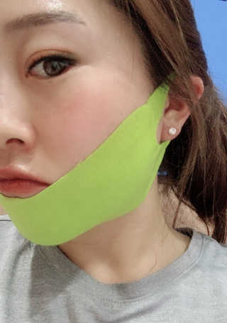 스케덤 시카 리프팅밴드 — 3점을 준 리뷰어가 2019년 4월 올린 사용 사진
