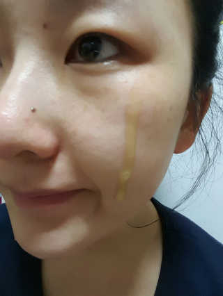 보타니티 [홍]조[진]정[결]케어 플라본 세럼 — 4점을 준 리뷰어가 2018년 5월 올린 사용 사진