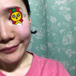 비알티씨 더 퍼스트 앰플 에센스 — 5점을 준 리뷰어가 2019년 4월 올린 사용 사진