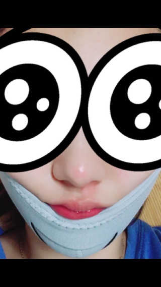 메디미 브이미 업 2스텝 브이라인벨트 — 4.17점을 준 리뷰어가 2017년 9월 올린 사용 사진