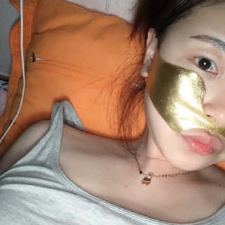 [스케덤] 상악밴드 — 4점을 준 리뷰어가 2019년 7월 올린 사용 사진