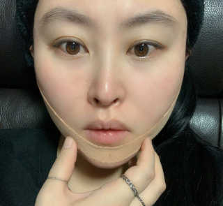 아이디플라코스메틱 아이디 페이스핏 마이너스 밴드 — 5점을 준 리뷰어가 2020년 1월 올린 사용 사진