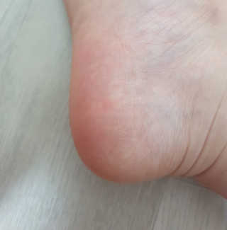 (주)에네스티 에네스티 수안수 실크스킨 풋크림 1+1 — 5점을 준 리뷰어가 2019년 9월 올린 사용 사진