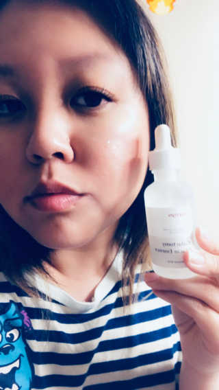 [마녀 공장] 발가락 토미 니아신 에센스 50ml — 5점을 준 리뷰어가 2019년 4월 올린 사용 사진