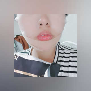 아이디플라코스메틱 아이디 페이스핏 마이너스 밴드 — 5점을 준 리뷰어가 2019년 10월 올린 사용 사진