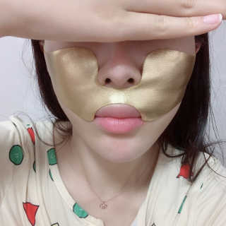 [스케덤] 상악밴드 — 3점을 준 리뷰어가 2019년 6월 올린 사용 사진