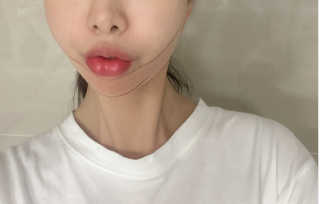 아이디플라코스메틱 아이디 페이스핏 마이너스 밴드 — 5점을 준 리뷰어가 2020년 1월 올린 사용 사진