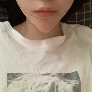 아이디플라코스메틱 아이디 페이스핏 마이너스 밴드 — 4점을 준 리뷰어가 2019년 8월 올린 사용 사진