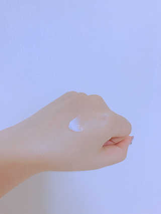 나이팅게일 티타민 크림 리뉴얼 — 5점을 준 리뷰어가 2018년 4월 올린 사용 사진