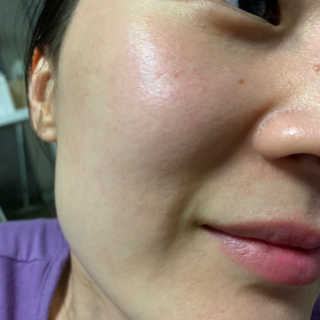 크리앙홀딩스 닥터 락슈미라 4D 리프팅 앰플 — 4점을 준 리뷰어가 2019년 7월 올린 사용 사진
