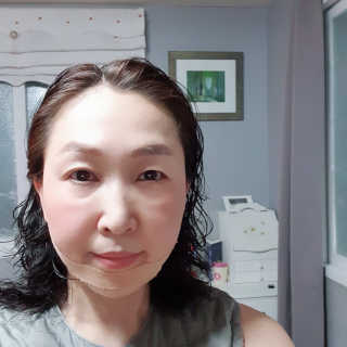 아이디플라코스메틱 아이디 페이스핏 마이너스 밴드 — 5점을 준 리뷰어가 2020년 3월 올린 사용 사진