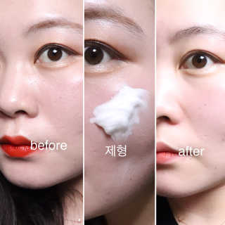 아크웰 아크네 클리어링 딥 클렌징 폼 — 5점을 준 리뷰어가 2018년 11월 올린 사용 사진