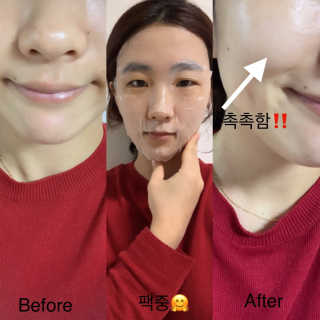 오지아이 마누카 허니 딥 케어 마스크 25ml X 10pcs — 5점을 준 리뷰어가 2020년 1월 올린 사용 사진