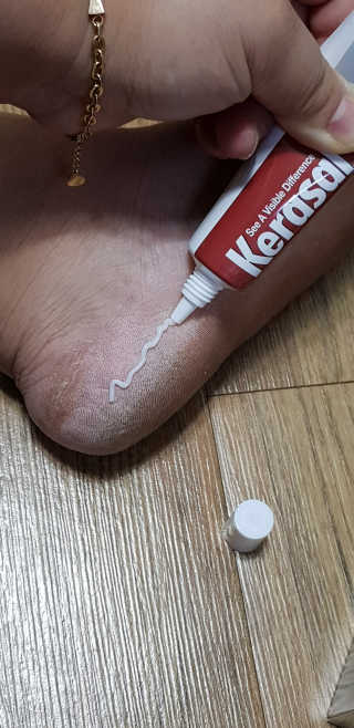 케라셀 풋크림 케라셀 인텐시브 풋 리페어 — 5점을 준 리뷰어가 2019년 10월 올린 사용 사진