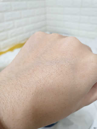 나이팅게일 티타민 크림 리뉴얼 — 4점을 준 리뷰어가 2018년 11월 올린 사용 사진