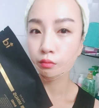 아이디플라코스메틱 아이디 페이스핏 마이너스 밴드 — 5점을 준 리뷰어가 2019년 9월 올린 사용 사진