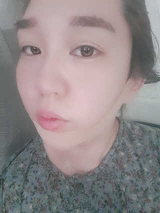 아이디플라코스메틱 아이디 페이스핏 마이너스 밴드 — 4점을 준 리뷰어가 2019년 11월 올린 사용 사진