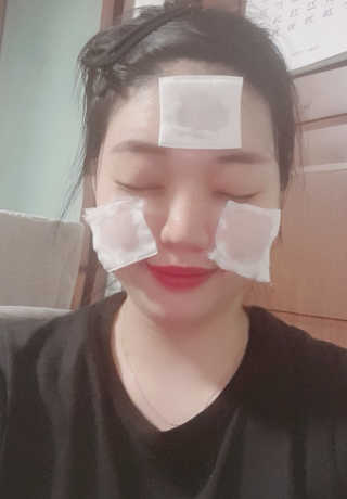 스킨그래머 슈퍼 굿 리페어 에센스 — 3.5점을 준 리뷰어가 2019년 5월 올린 사용 사진