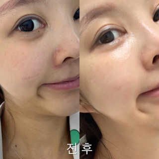 미니님이 올린 리뷰 사진 1