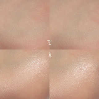 Bio-oil(바이오오일) 바이오오일 — 4.5점을 준 리뷰어가 2016년 10월 올린 사용 사진